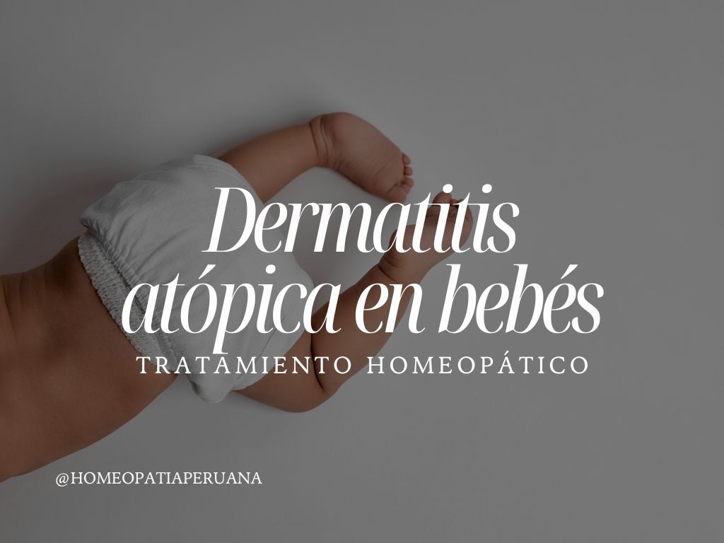 Tratamiento homeopático para la dermatitis atópica en bebés